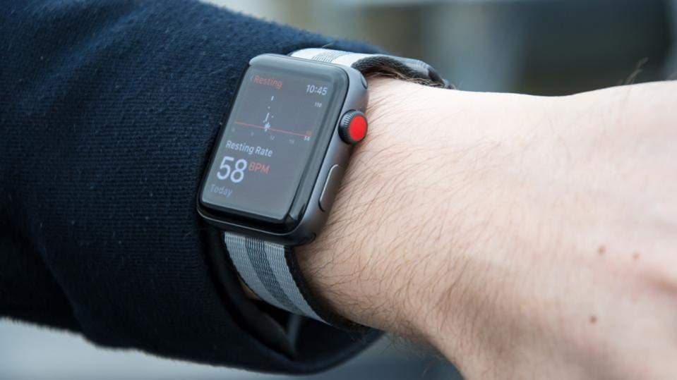 smartwatch